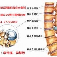 哈尔滨市李氏颈腰间盘突出专科0451-57765840